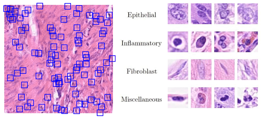 Histopathology Cancer Cell Classification preview